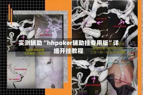 实测辅助“hhpoker辅助挂专用版”详细开挂教程