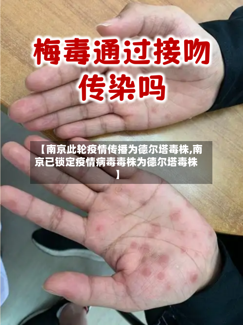 【南京此轮疫情传播为德尔塔毒株,南京已锁定疫情病毒毒株为德尔塔毒株】